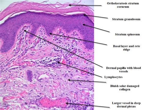 DermPath .